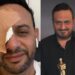خالد سرحان يتسبب في أذية مصطفى قمر