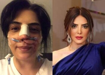 حورية فرغلي وقصة خضوعها لعمليات التجميل !