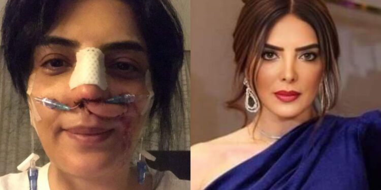 حورية فرغلي وقصة خضوعها لعمليات التجميل !